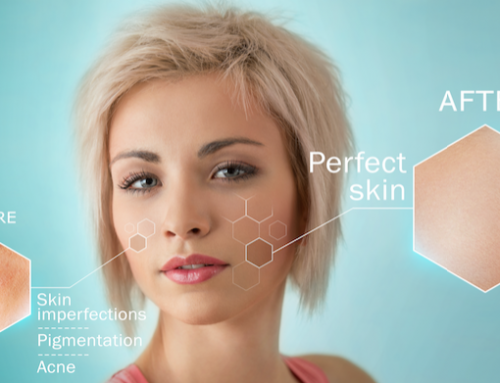 Different Skin Types and Proper Care